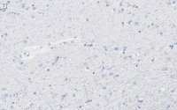 Anti-Aquaporin-4 Antibody, clone 1K2 ZooMAb Rabbit Monoclonal 
