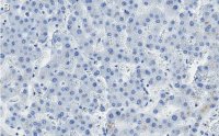 Anti-Aquaporin-9 Antibody, clone 1E4 ZooMAb Rabbit Monoclonal 