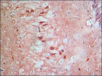 Anti-Arc (N-terminal) antibody produced in rabbit SAB4200461-200UL