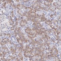 Anti-ARFGAP3 antibody produced in rabbit HPA000638-100UL
