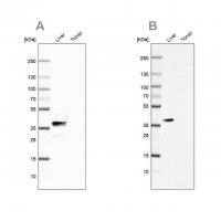 Anti-ARG1 antibody produced in rabbit 