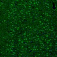Anti-ARHGAP1 antibody produced in rabbit HPA004689-100UL