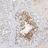 Anti-ARHGAP28 antibody produced in rabbit 