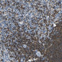 Anti-ARHGAP45 antibody produced in rabbit 