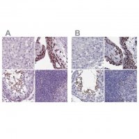 Anti-ARID3A 