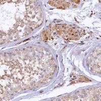 Anti-ARL11 antibody produced in rabbit HPA040855-100UL