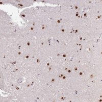 Anti-ARL14EP antibody produced in rabbit HPA048127-100UL