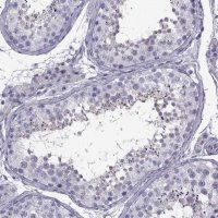 Anti-ARMC2 antibody produced in rabbit 