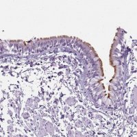 Anti-ARMC4 antibody produced in rabbit 
