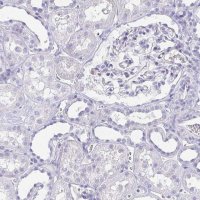ANTI-ARPP21 antibody produced in rabbit 