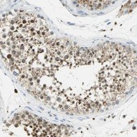 Anti-ARSA antibody produced in rabbit 