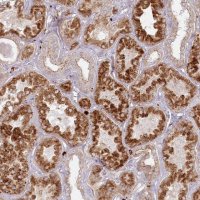 Anti-ARSB antibody produced in rabbit 