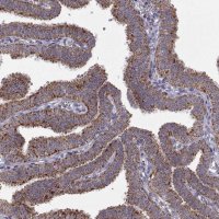 Anti-ARSD antibody produced in rabbit HPA004694-100UL