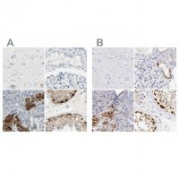 Anti-ASB9 antibody produced in rabbit HPA003014-100UL