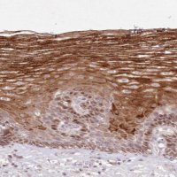 Anti-ASCC1 antibody produced in rabbit HPA038038-100UL