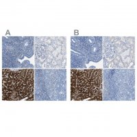 Anti-ASGR1 antibody produced in rabbit 