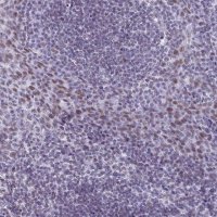 Anti-ASH2L antibody produced in rabbit 