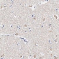 Anti-ASPHD2 antibody produced in rabbit 