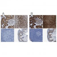 Anti-ASS1 antibody produced in rabbit 