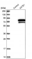 Anti-ASTE1 antibody produced in rabbit 