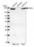 Anti-ATAD2 antibody produced in rabbit 