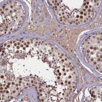 Anti-ATF7IP2 antibody produced in rabbit 