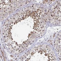 Anti-ATG3 antibody produced in rabbit 