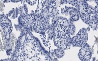 Anti-ATG7 Antibody, clone 1E15 ZooMAb Rabbit Monoclonal 