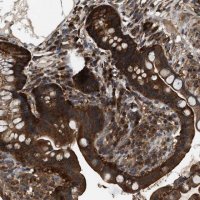 Anti-ATIC antibody produced in rabbit 