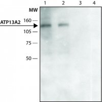 Anti-ATP13A2 (C-terminal region) antibody produced in rabbit 