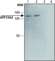 Anti-ATP13A2 (C-terminal) antibody produced in rabbit 