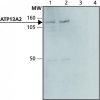 Anti-ATP13A2 antibody produced in rabbit 