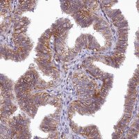 Anti-ATP2B4 antibody produced in rabbit 