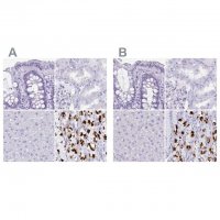 Anti-ATP4B antibody produced in rabbit 