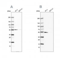 Anti-ATP5A1 antibody produced in rabbit HPA044202-100UL