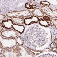 Anti-ATP5O antibody produced in rabbit HPA041394-100UL
