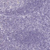 Anti-ATP6V0D2 antibody produced in rabbit HPA055327-100UL