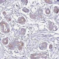 Anti-ATP6V1B1 antibody produced in rabbit 