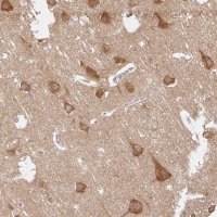 Anti-ATP8A1 antibody produced in rabbit 