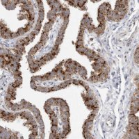 Anti-ATPIF1 antibody produced in rabbit HPA027999-100UL