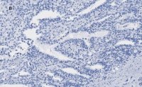 Anti-ATRX Antibody, clone 2A12, ZooMAb Rabbit Monoclonal 