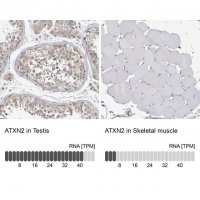 Anti-ATXN2 antibody produced in rabbit 