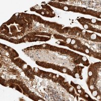 Anti-ATXN7L2 antibody produced in rabbit 