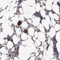 Anti-AUNIP antibody produced in rabbit 
