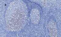 Anti-Aurora B Antibody, clone 7C4, ZooMAb Rabbit Monoclonal 