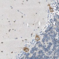 Anti-B4GALNT1 antibody produced in rabbit 