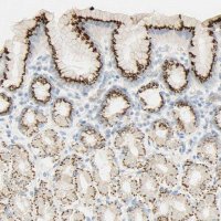 Anti-B4GALNT3 antibody produced in rabbit 