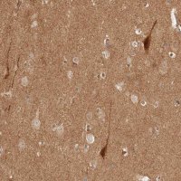 Anti-BAALC antibody produced in rabbit 