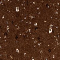 Anti-BAIAP2 antibody produced in rabbit 