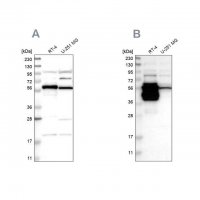 Anti-BAIAP2L1 antibody produced in rabbit 